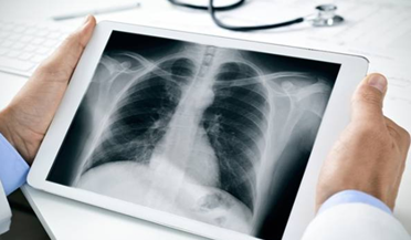 Digital X-Ray